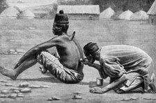 Cupping, wet and dry, as a therapeutic measure, Africa, 1922.Artist: FW Taylor