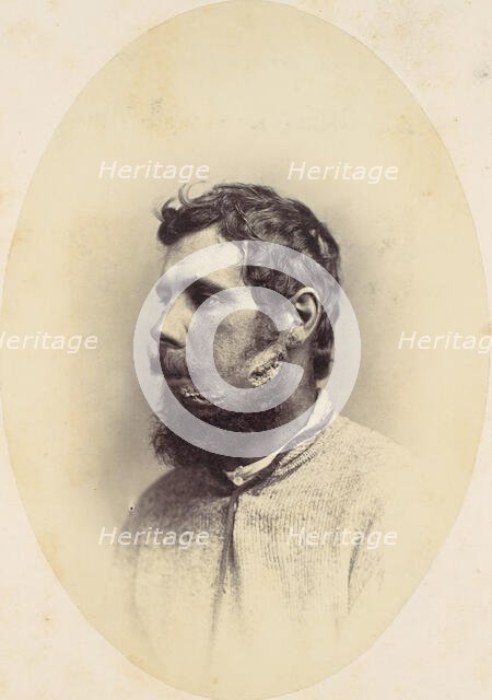 Andrew Wagoner, 1865. Creator: Reed Brockway Bontecou.