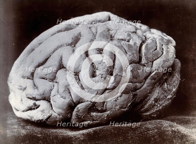 A brain, viewed from the side, supposedly from a subject with mental deficiency. Creator: N. Goulton May.
