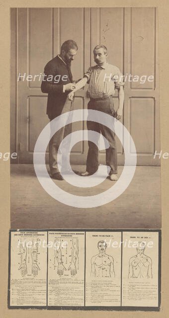 Notation of Scars, Schematic Drawings, ca. 1893. Creator: Alphonse Bertillon.