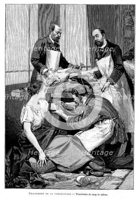 A tuberculosis patient being given a transfusion of goat's blood, 1891. Artist: Unknown