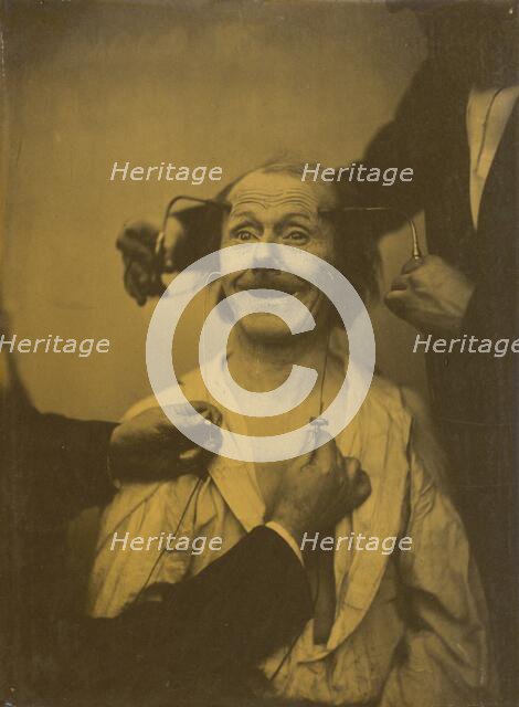 A false, incomplete expression of agreeable surprise, or admiration, 1854-1856, printed 1862. Creator: Duchenne de Boulogne.