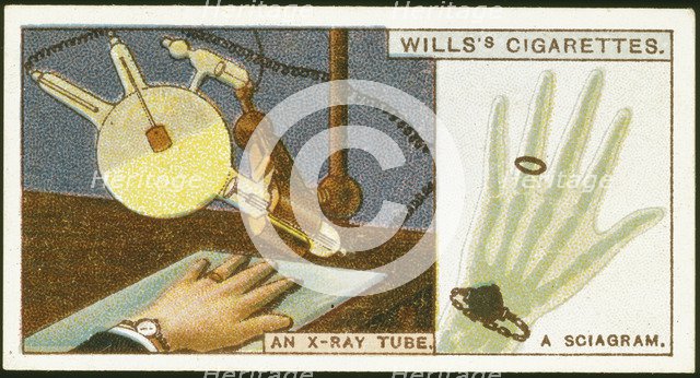 X-raying the hand, 1924. Artist: Unknown
