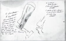 (Untitled) (Anatomical Study Of Bones), 1878. Creator: Thomas Eakins.