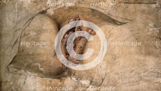 Female genitalia covered with syphilitic warts, c1824. Creator: Unknown.