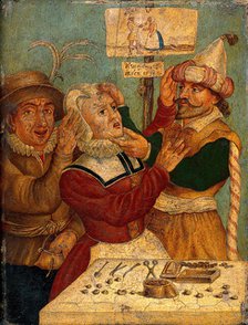 A surgeon extracting "pierres de tête", c1660s. Creator: Unknown.