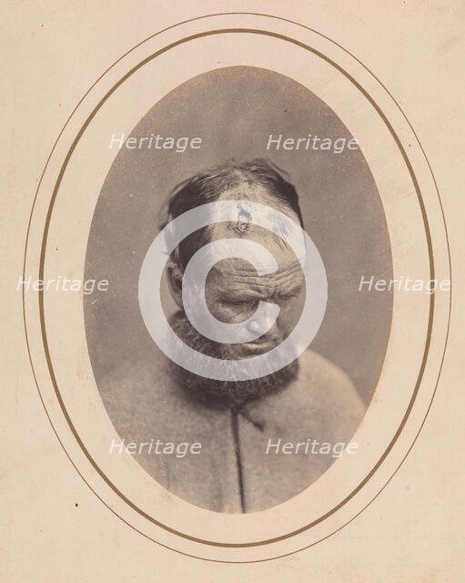 Private John Parkhurst, Company E, Second New York Heavy Artillery, 1865. Creator: Reed Brockway Bontecou.