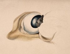 A diseased eye. Creator: Unknown.