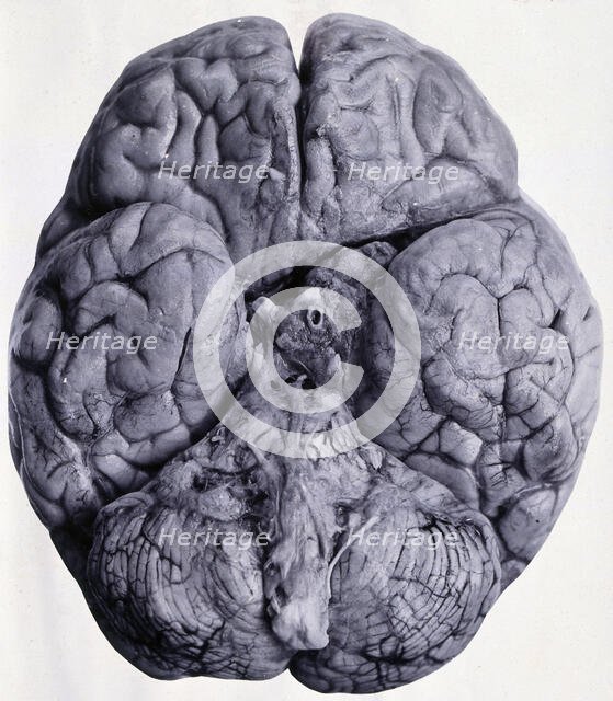 Friern Hospital, London: a brain, seen from beneath, 1890/1910. Creator: Unknown.