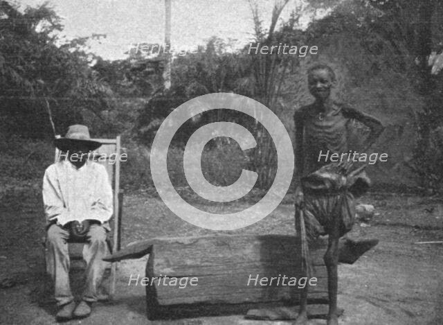 ''Indigene du Congo atteint de la maladie du sommeil; L'Ouest Africain', 1914. Creator: Unknown.