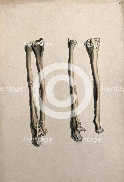 Radius and ulna bones: two figures, 1830-1835. Creator: Unknown.