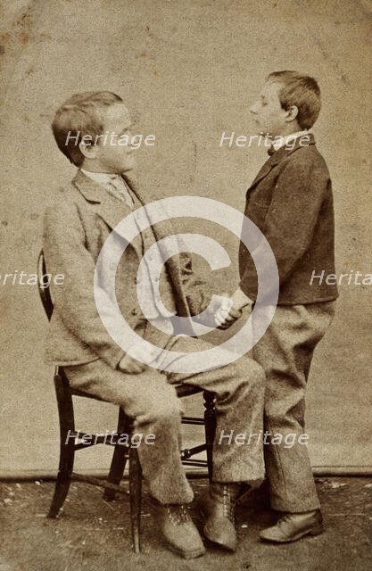 Down's syndrome: in two young men holding hands, one sitting and one standing, c1880s. Creator: Unknown.
