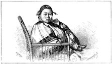 Woman with bound feet, China, 19th century. Artist: E Ronjat