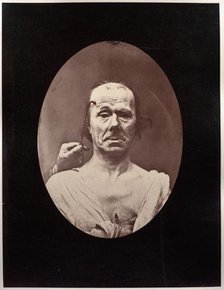 Figure 7: Étude du méchanisme et de lexpression du muscle frontal chez un vieillard: à droit..., c.  Creator: Guillaume-Benjamin-Amand Duchenne (de Boulogne) (French, 1806-1875); Adrien Tournachon (French, 1825-1903).
