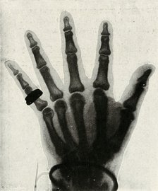 'Radiograph of the Hand of H.R.H. The Prince of Wales', (c1897). Artist: Unknown.