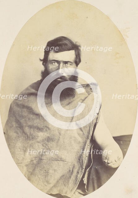 Herman Rice, 1865. Creator: Reed Brockway Bontecou.