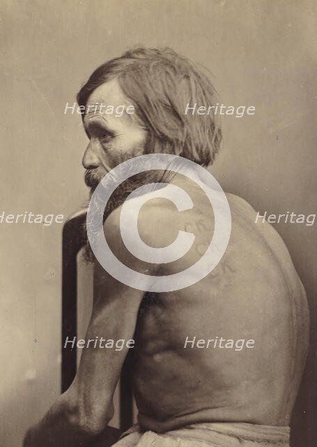 Branding on the Cheeks and Back of Forced Labor Convicts and on the Arms of a Vagrant, 1891. Creator: Aleksei Kuznetsov.