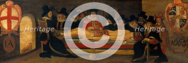 The dissection of a corpse before a company of surgeons, c1665. Creator: Unknown.