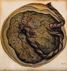 The placenta and umbilical cord, 1800-1860. Creator: John Lizars.