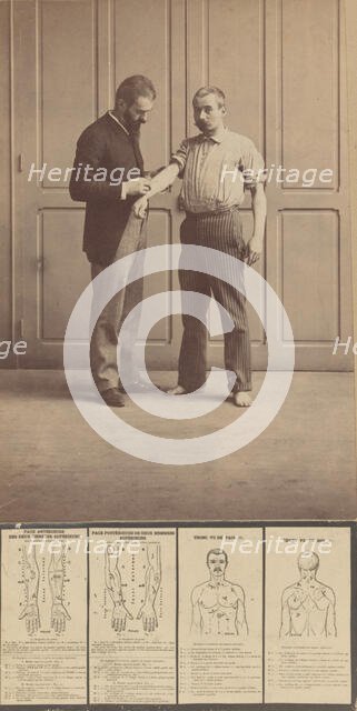 Notation of Scars, Schematic Drawings, ca. 1893., ca. 1893. Creator: Alphonse Bertillon.