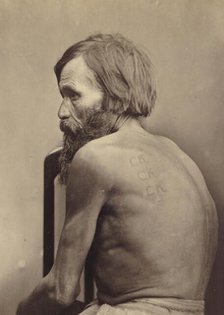 Branding on the Cheeks and Back of Forced Labor Convicts and on the Arms of a Vagrant, 1891. Creator: Aleksei Kuznetsov.
