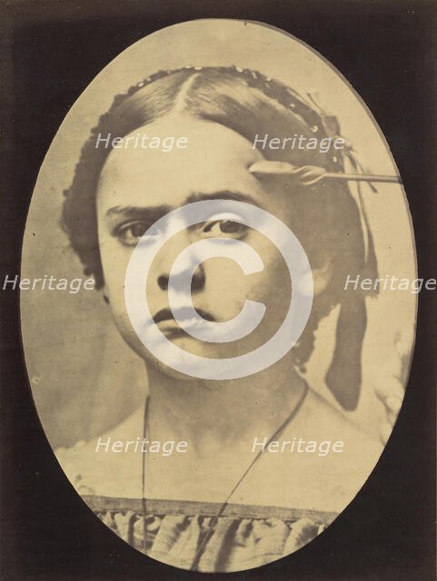 Figure 10: Showing the expressive lines of m. frontalis in a young girl , 1854-56, printed 1862. Creators: Duchenne de Boulogne, Adrien Alban Tournachon.