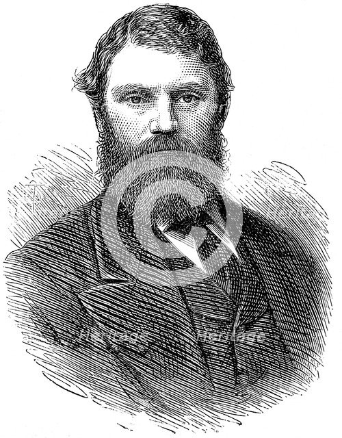Francis Edmund Anstie (1833-1874), English physician, 1874. Artist: Unknown
