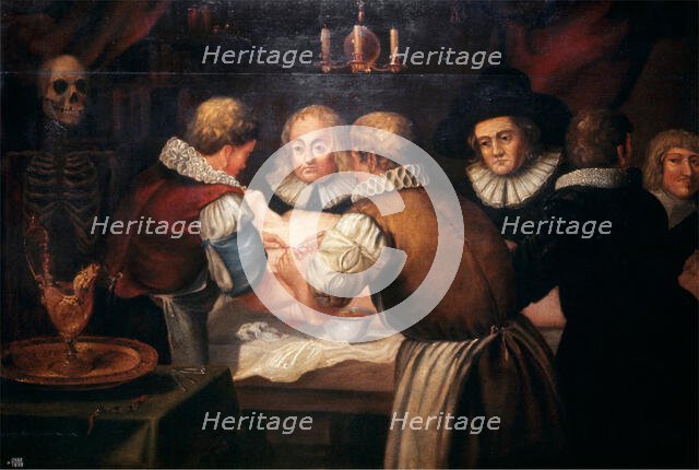 Surgeons performing an operation on a woman's breast in the seventeenth century. Creator: Unknown.